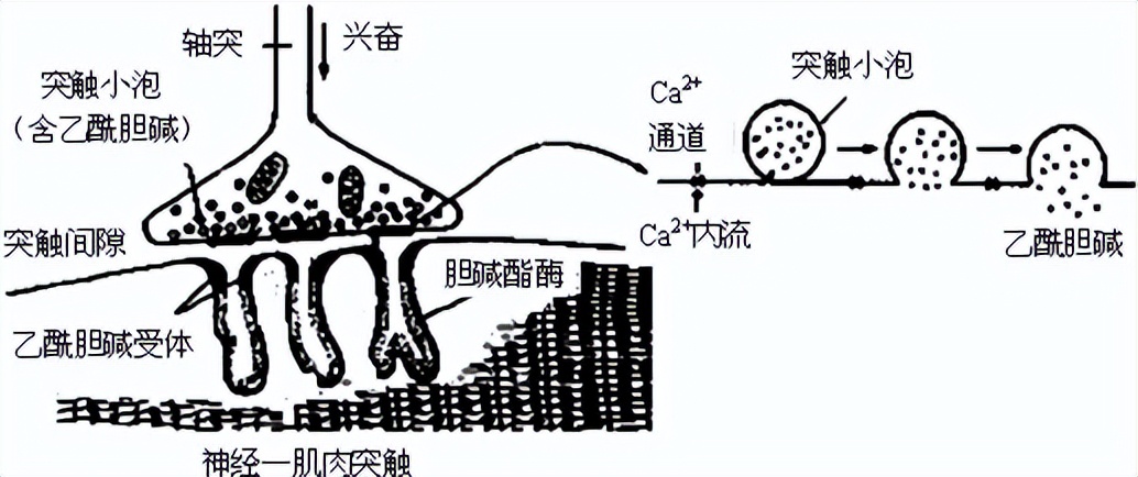 老年人轻微脑萎缩怎么预防,老年人脑萎缩吃什么药有效