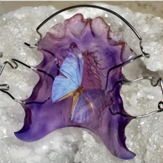 拔牙矫正后多长时间能合缝,拔牙矫正需要缝线吗