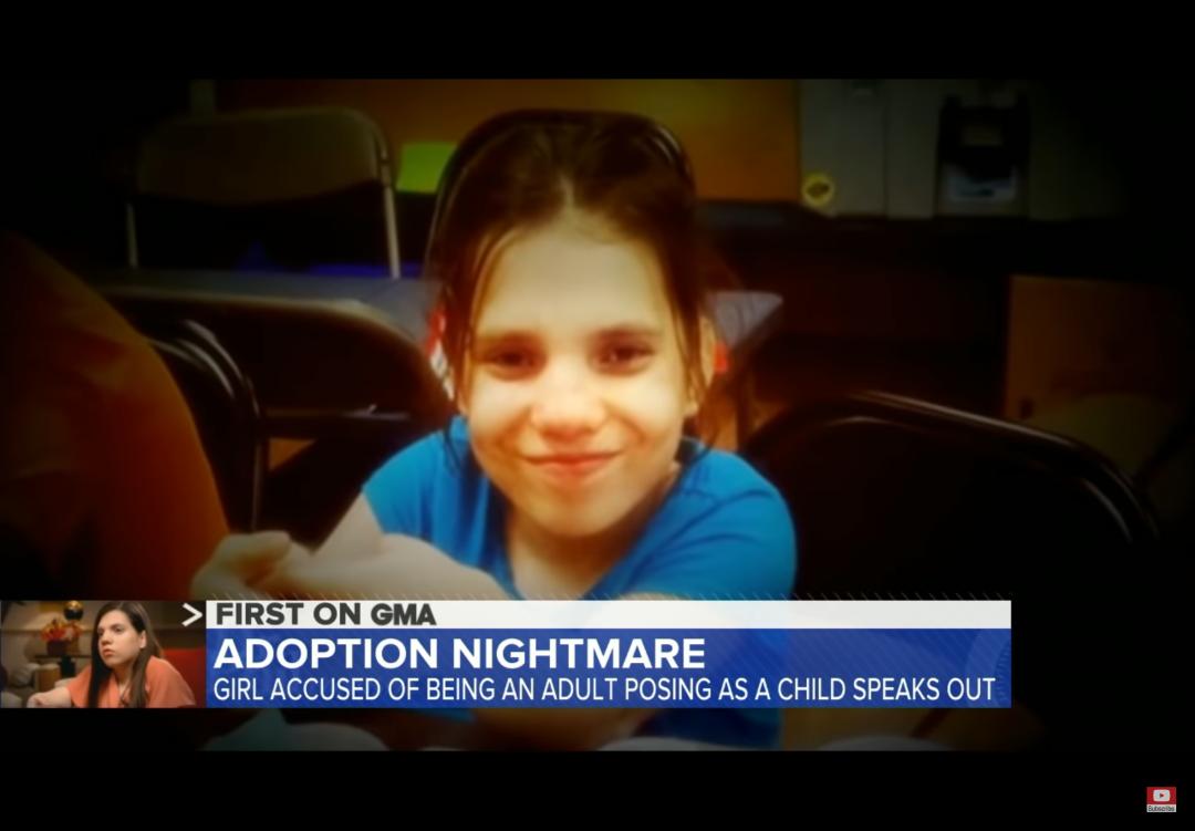 夫妇好心收养6岁女孩，发现竟是20岁侏儒假扮，还试图杀死他们