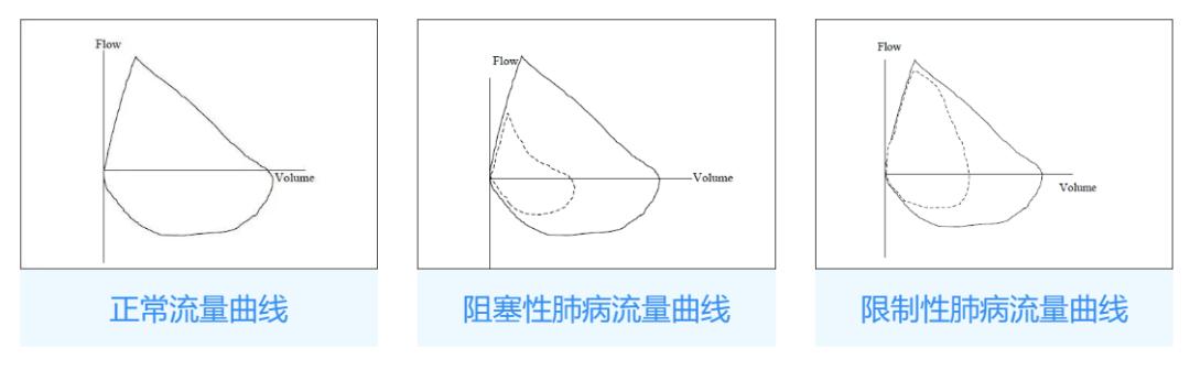 肺功能报告单怎么看专家详解,肺功能几个指标的最新判定