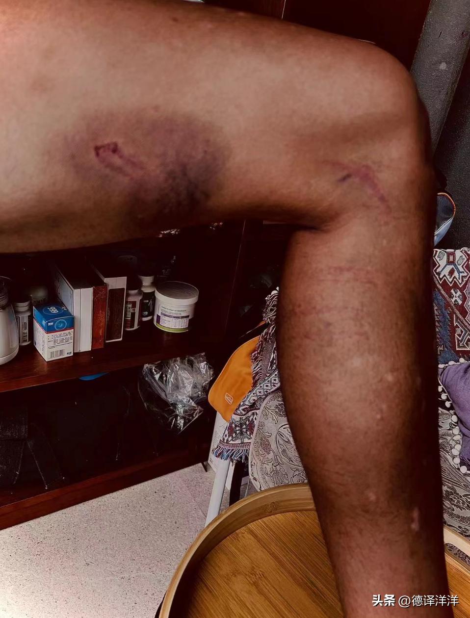 赛后还能补哨？中超赛场又现奇景，战术犯规也要追罚