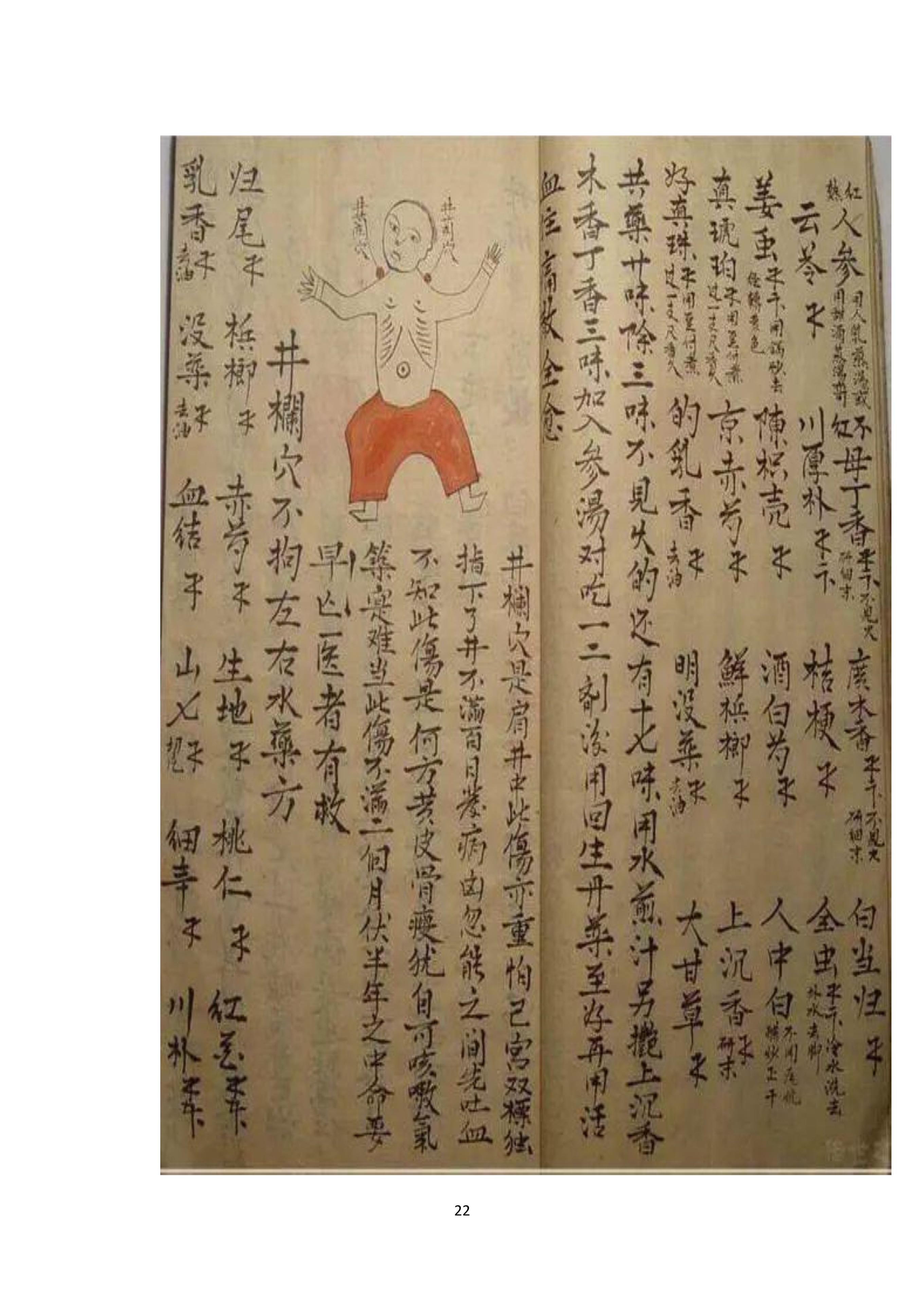 中医古书籍清代带图且内容非常好的手抄跌打损伤良方