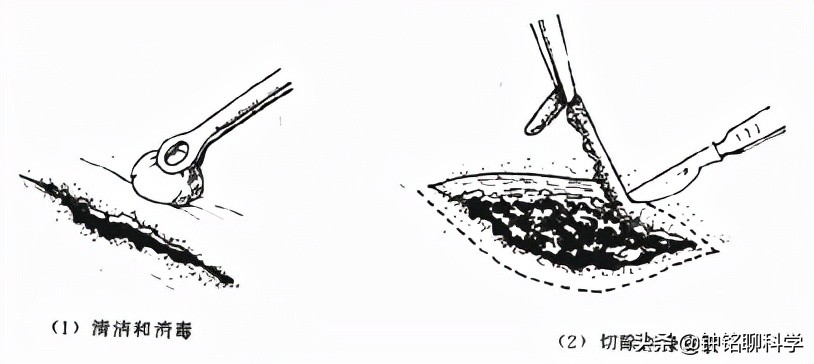铔嗚櫕涓轰粈涔堣兘娌荤枟婧冪儌浼ゅ彛,铔嗚櫕鑳芥不鐤椾激鍙ｆ劅鏌撳悧