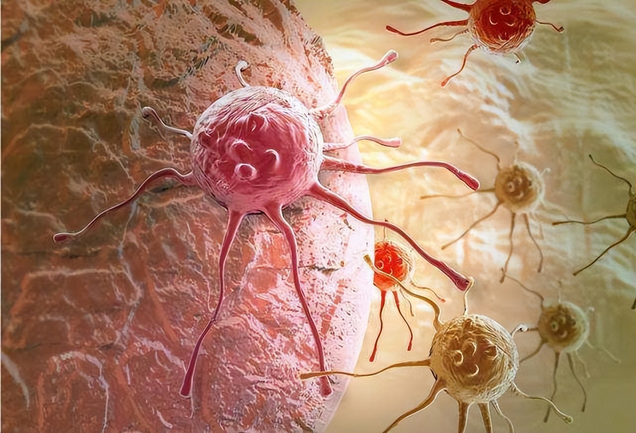 囊肿切除手术需要注意什么,囊肿手术切除需要注意什么