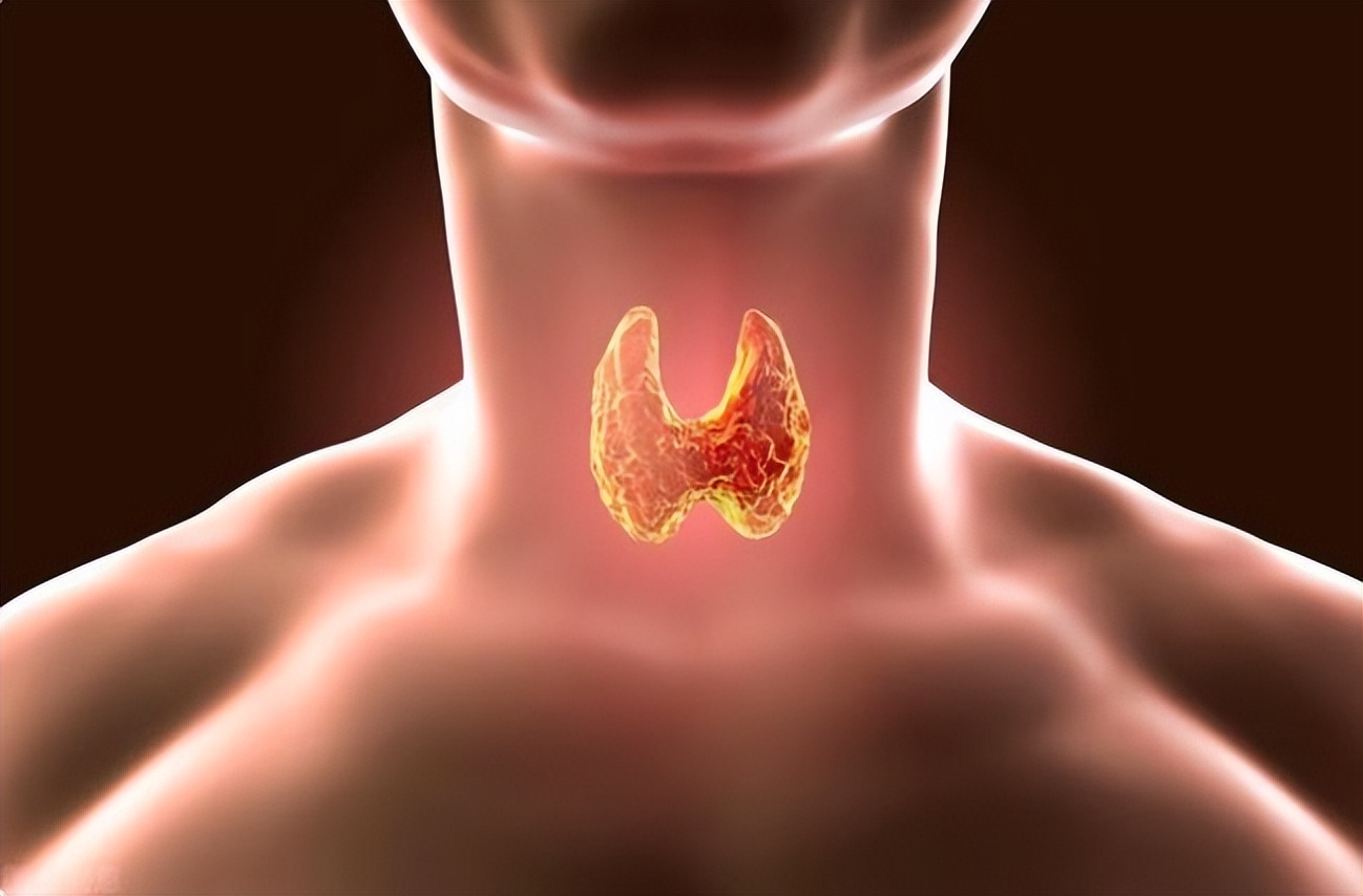 甲减长期吃优甲乐有什么副作用,如何避免甲癌优甲乐长期吃副作用