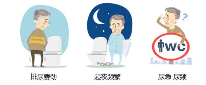 前列腺增生克星中成药原理,前列腺增生克星中成药