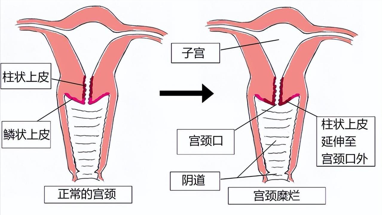 体检查出这十种病不用治疗,真正的医院不建议体检的三种病