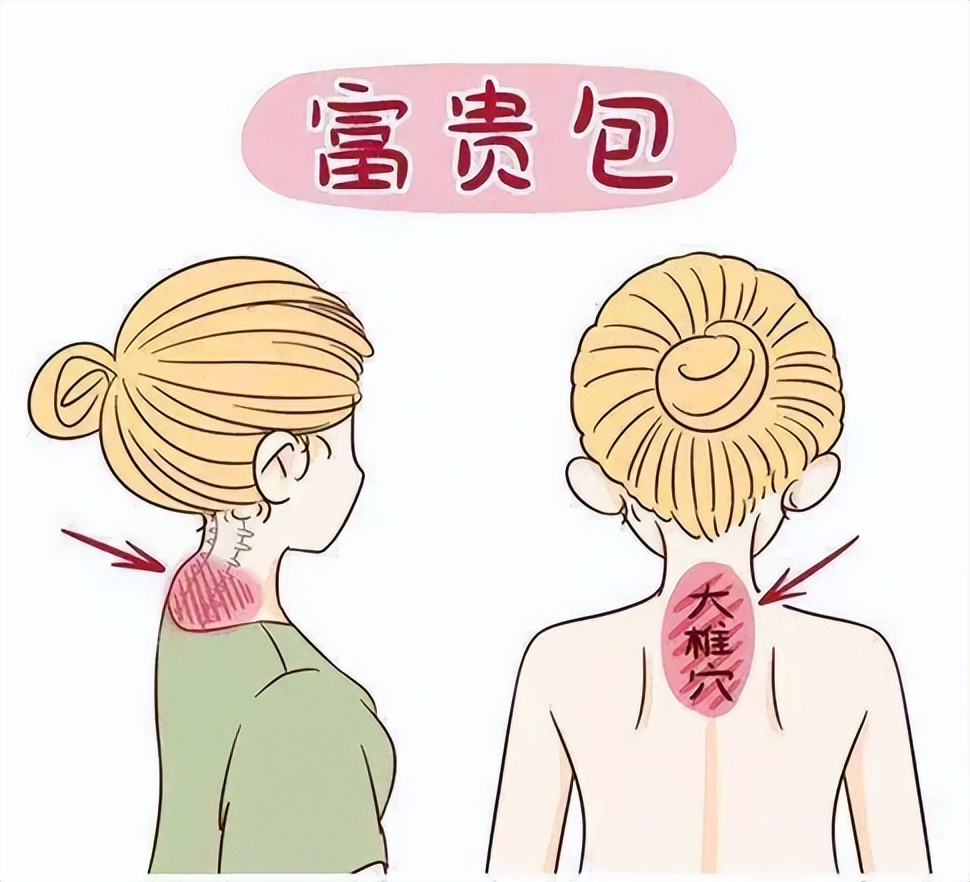 什么是运动康复mtt,什么是运动康复专业