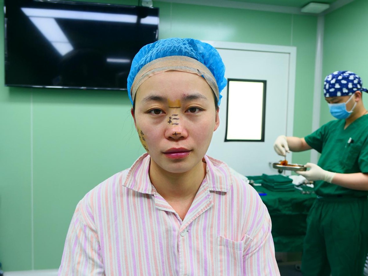 25岁天津女孩,19岁女子瞒着父母去整容