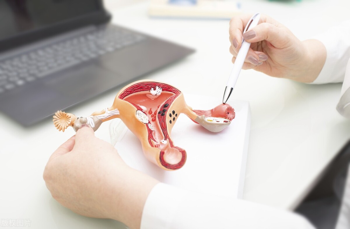 女性“阴吹”是什么？这种情况正常吗？别害羞，还有4个治疗方法