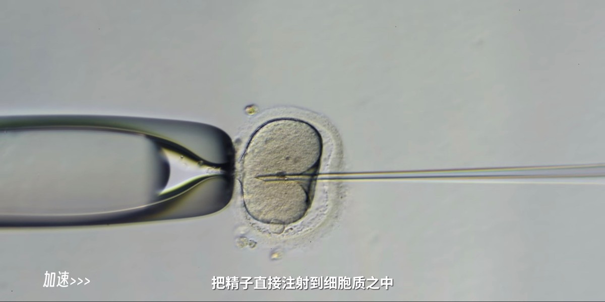 精子捐赠为什么会不合格,精子捐献不合格是有问题吗