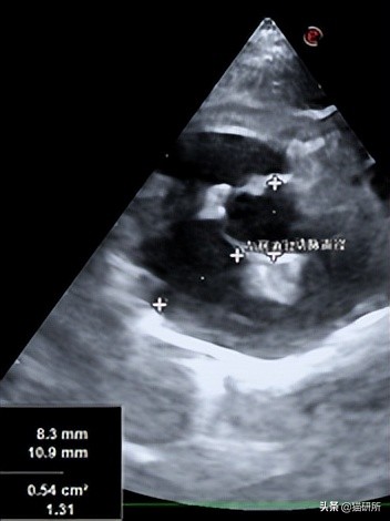 猫肥厚型心肌病分几期,猫得了hcm肥厚型心肌病