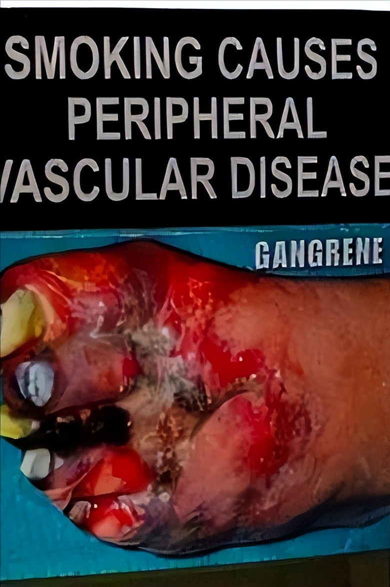 烟盒上的秘密有多可怕,加拿大香烟危害