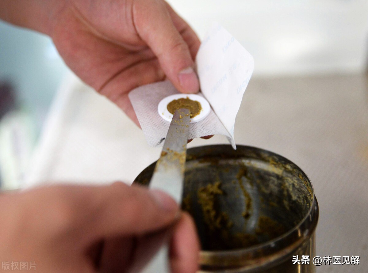 前列腺脐疗,脐疗对前列腺有帮助吗