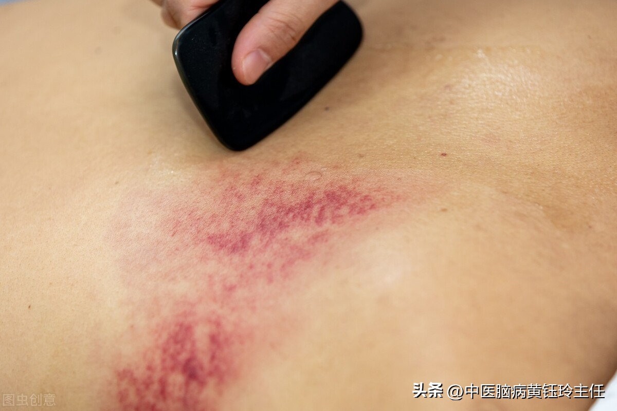 中医面部刮痧祛斑视频教程,想学中医按摩刮痧应该怎么学