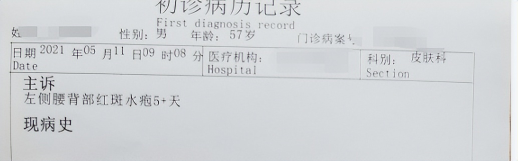 缠腰蛇疱疹轻了为什么特别疼,带状疱疹蛇缠腰神经痛