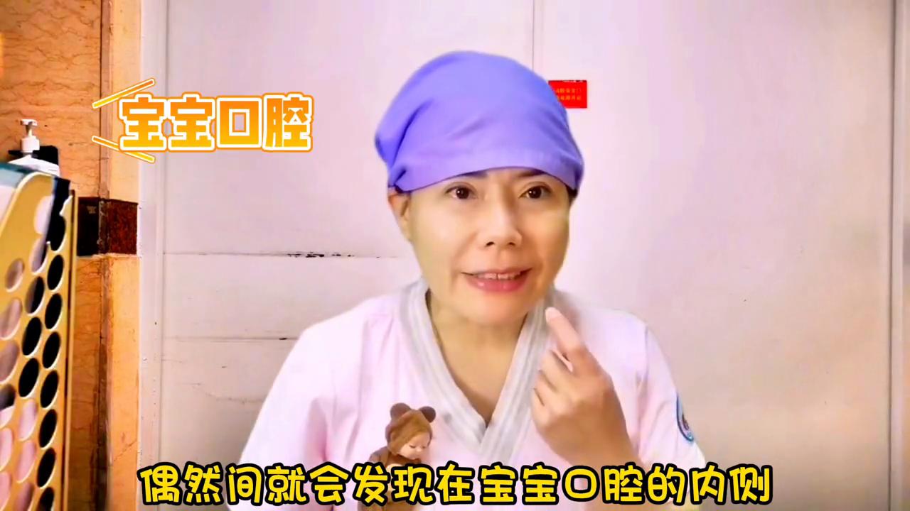 两个月宝宝口腔里有小白点怎么办,宝宝口腔小白点是什么原因