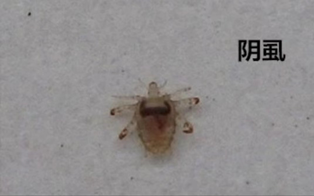 阴虱是什么？为什么现在很多人得阴虱？医生：离不开3个传播途径