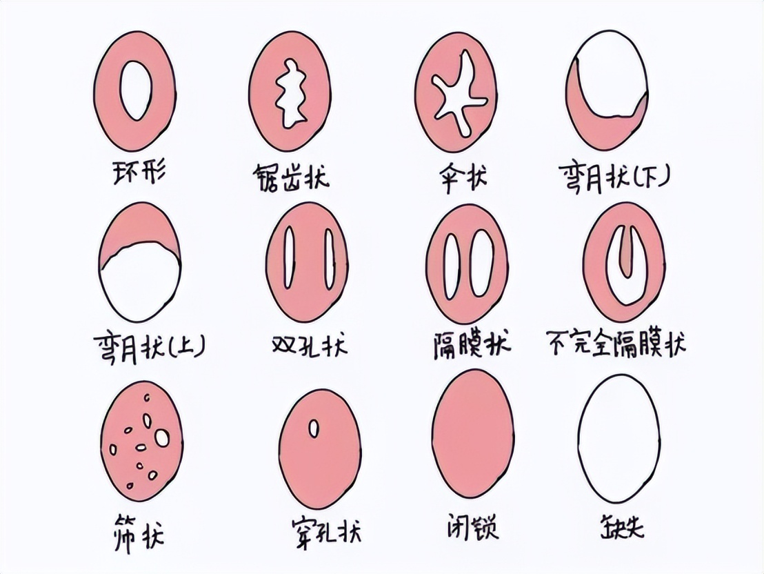 处女的第一次一定会出血？这层膜到底有啥用？别被男人“*脑洗**”了