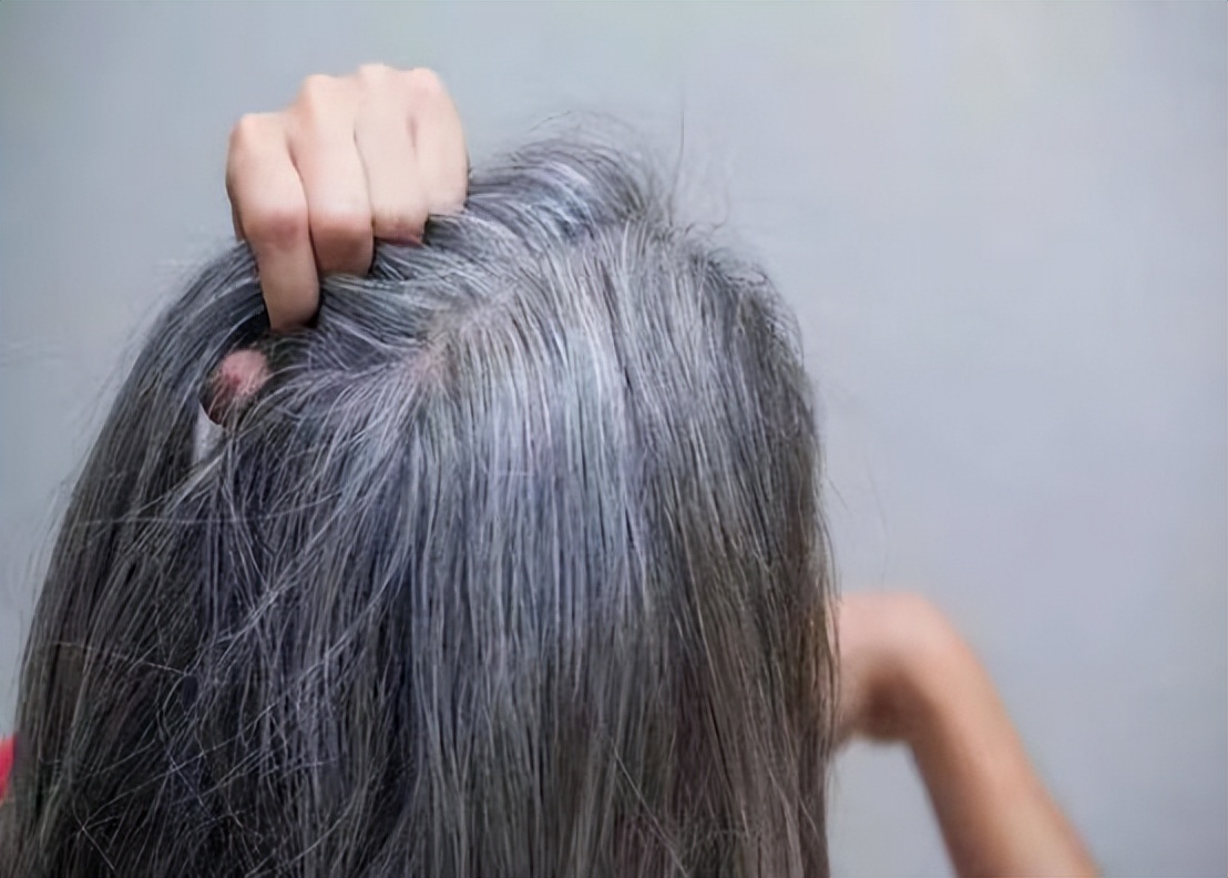 女性白头发增多怎么回事,女性有白头发缺什么