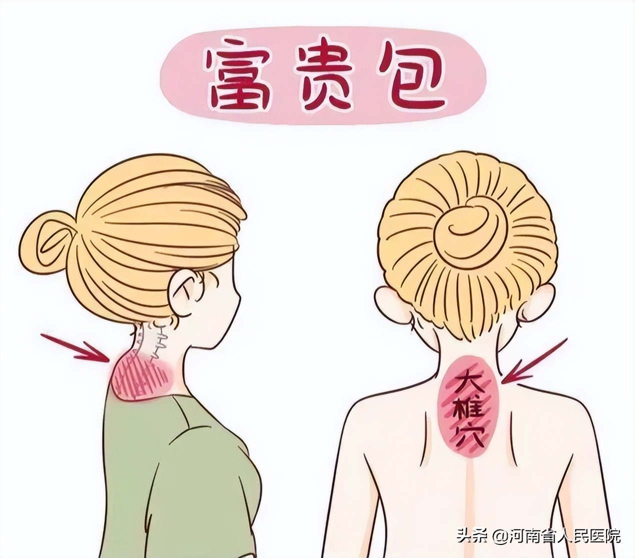 一小时，让她卸下背了十余年的“包袱”