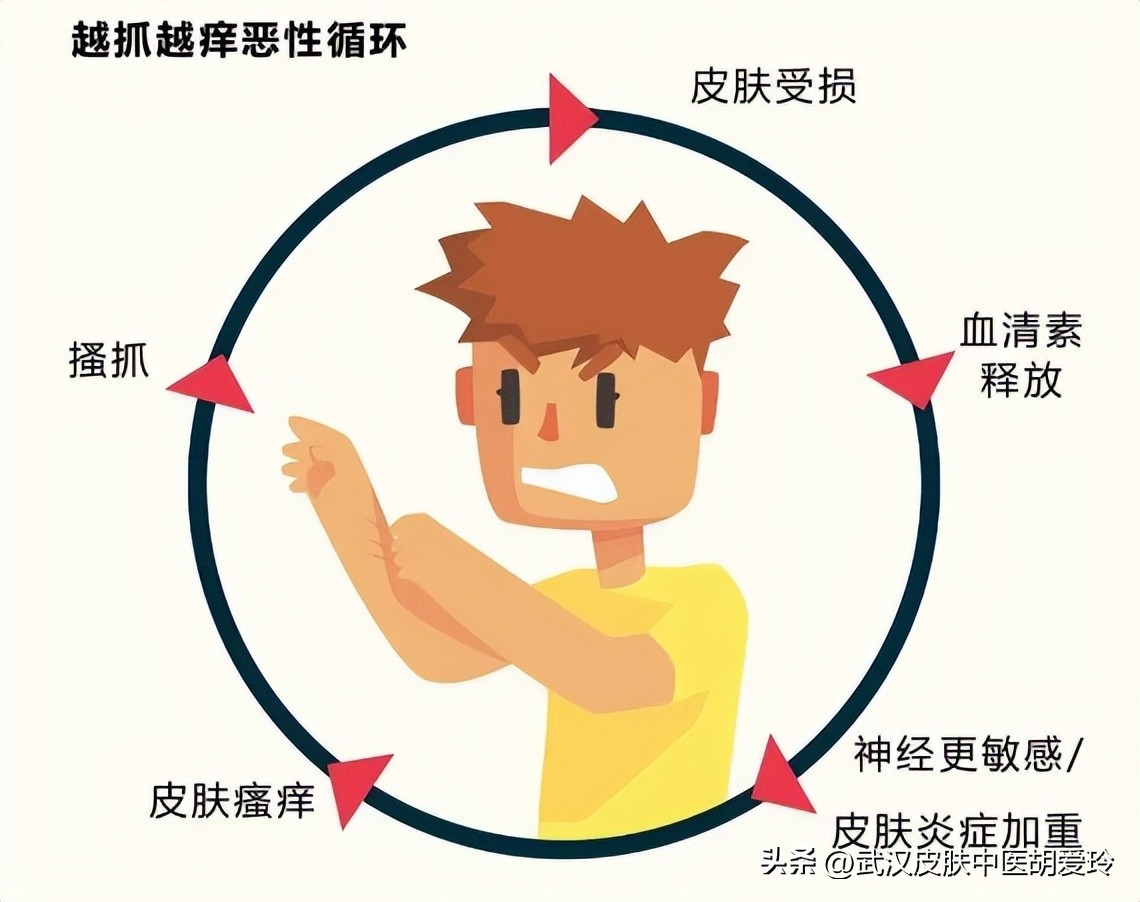 身上特别痒越抓越痒出血结痂,身上痒一抓一条条印子还结痂