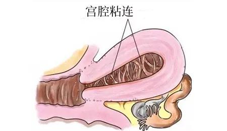 如果想要好孕需要注意哪些细节呢,想要好孕这些问题千万得注意