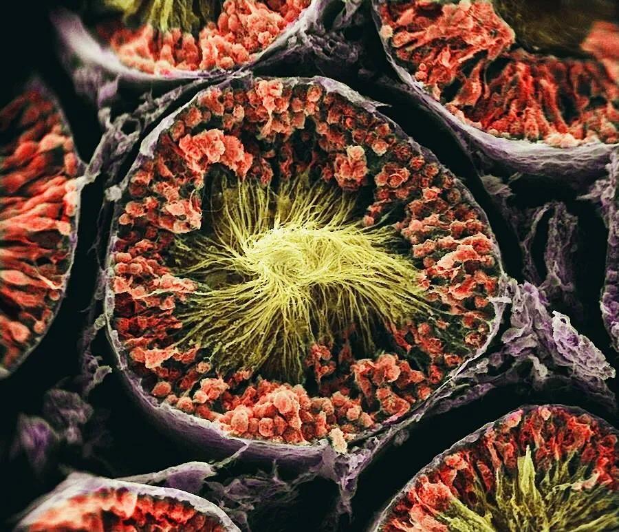 显微镜观察人体的四种组织图片,人体显微镜下的样子