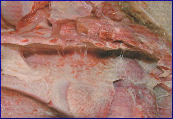 猪的巴氏杆菌病症状和治疗,猪的巴氏杆菌怎样才能彻底消灭