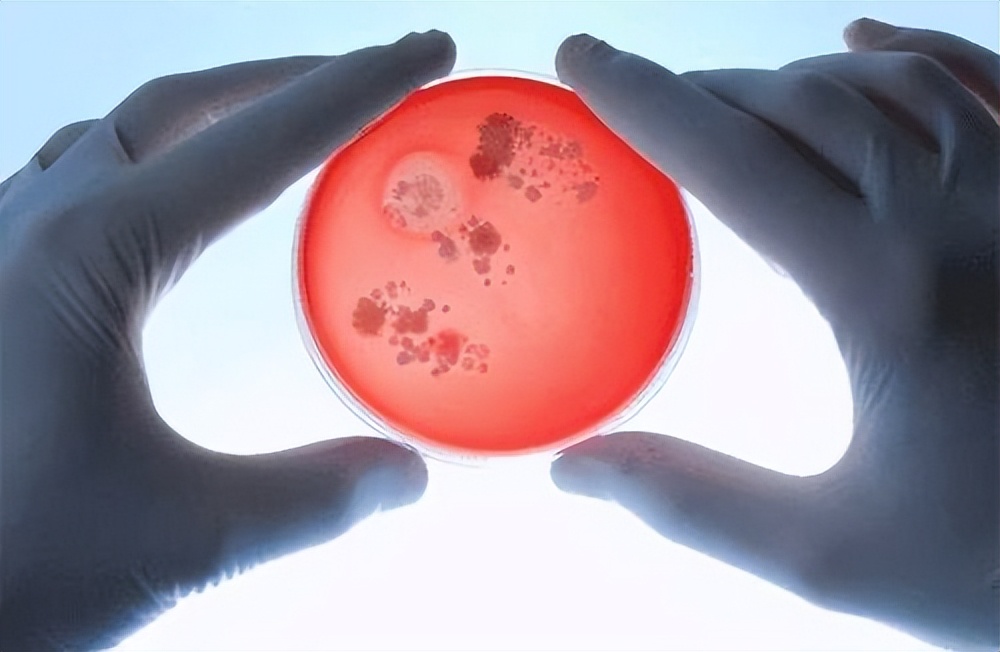 女子四处求医治便秘,结果走一大圈弯路,专家:我有一个更好方案