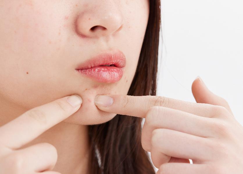 中医认为身上起疙瘩很痒怎么治疗,皮肤长痘平时吃什么调理