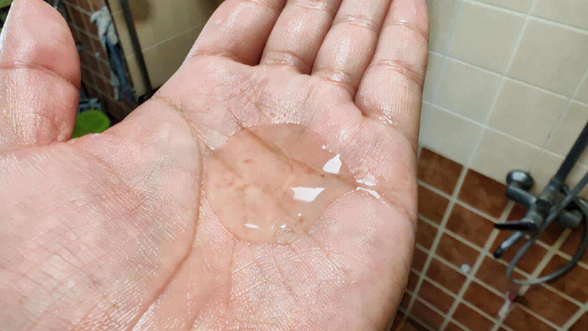 去头皮屑防掉发的洗发水推荐,脱发痒用哪一款洗发水比较好