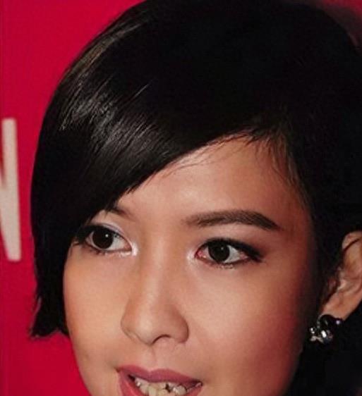 明星烤瓷牙发黑,明星烤瓷牙牙齿磨小后照片