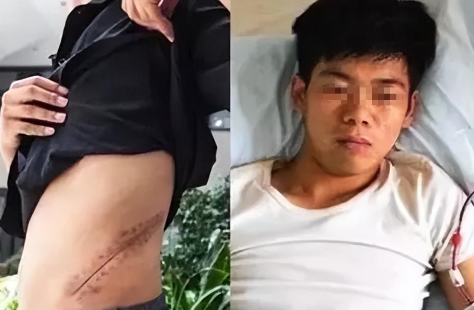 当年卖肾换苹果的男孩还在吗,当年卖肾换苹果小伙去世