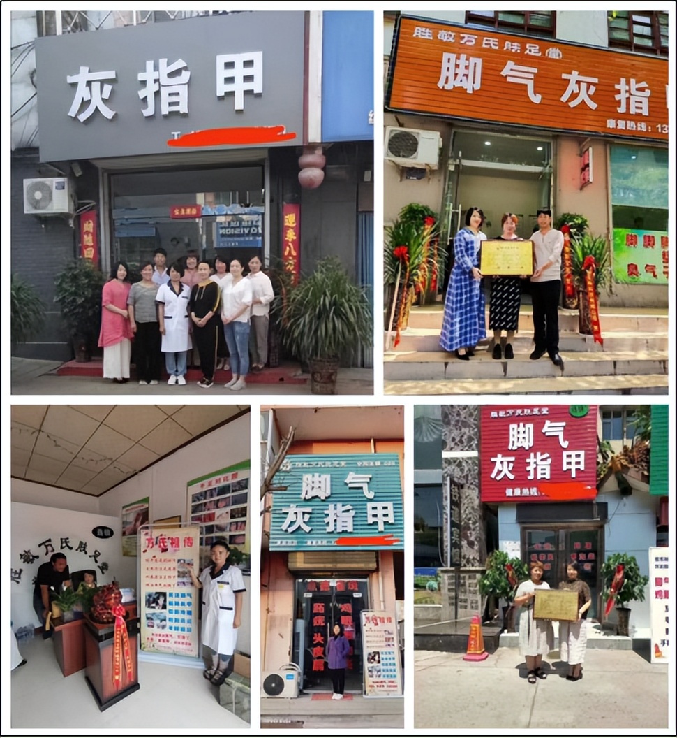 专业治脚气全国招商,脚气药加盟