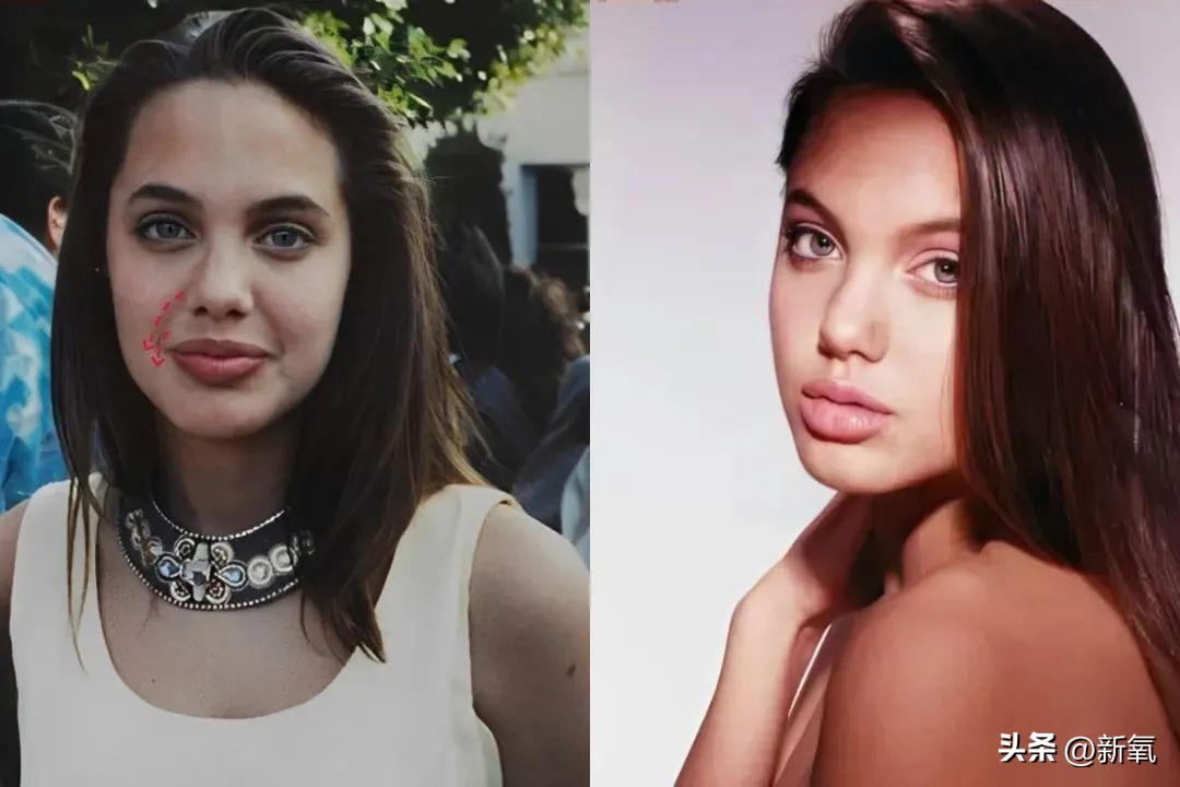 牙齿正畸和骨骼正畸的区别,牙齿正畸和眼轴增长有关系吗