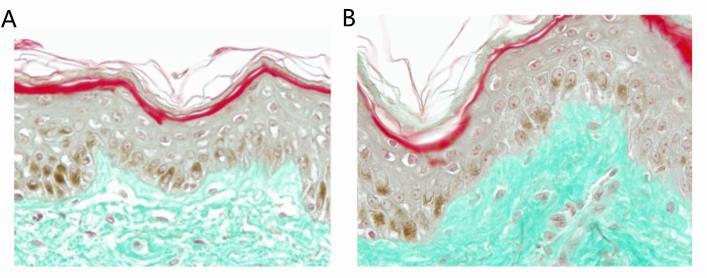 积雪草跟油橄榄哪个消炎效果好 (油橄榄和积雪草哪个适合油皮)