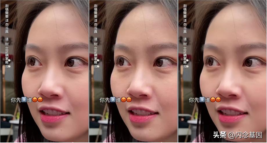 窄带高清,窄带高清技术讲解