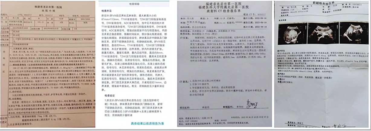 陈海林治疗癌症,陈海林肿瘤名医