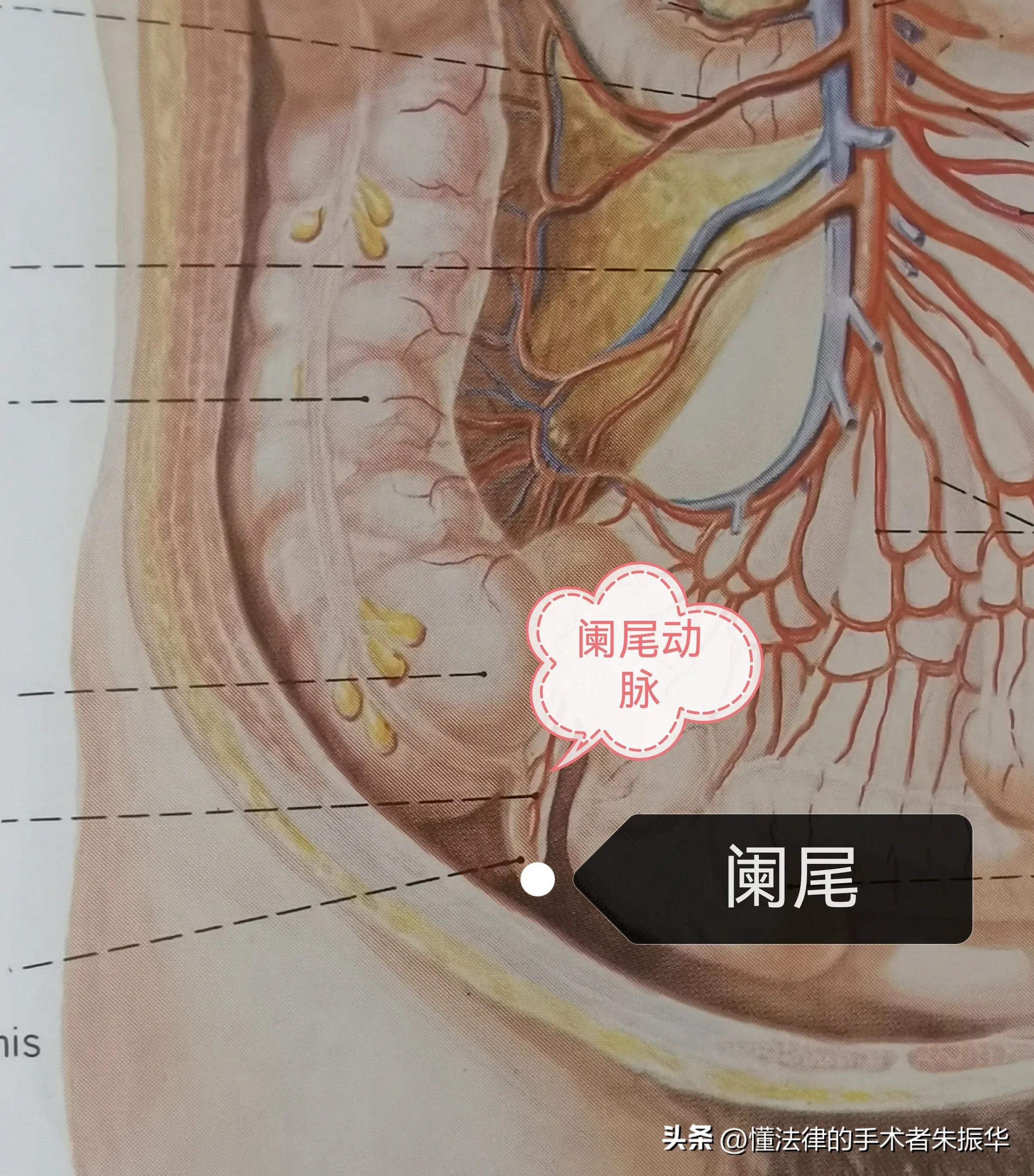 手术后出血一定要谨慎处理