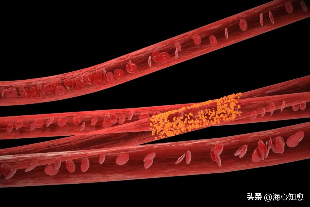 放疗有这么多危害为什么还要做呢,放疗期间的饮食要注意哪些事项