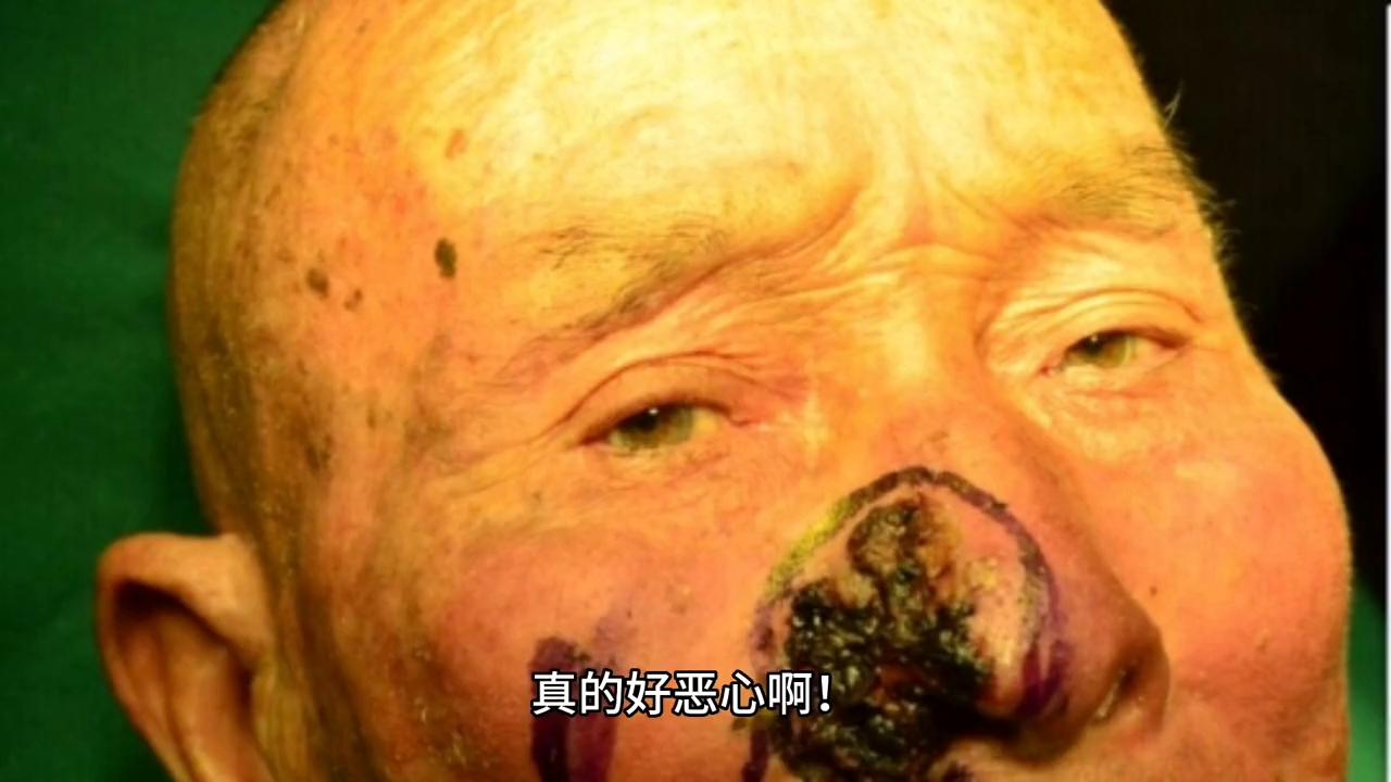 泥膜清洁完皮肤怎么护理,敷泥膜的正确方法