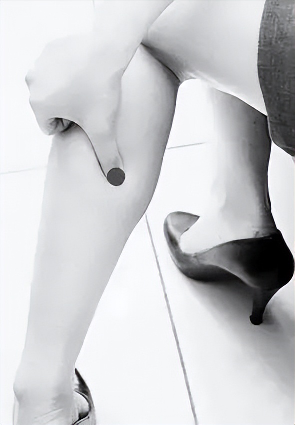 小腿蚯蚓状的静脉曲张怎么办,蜘蛛网型的静脉曲张怎么治疗