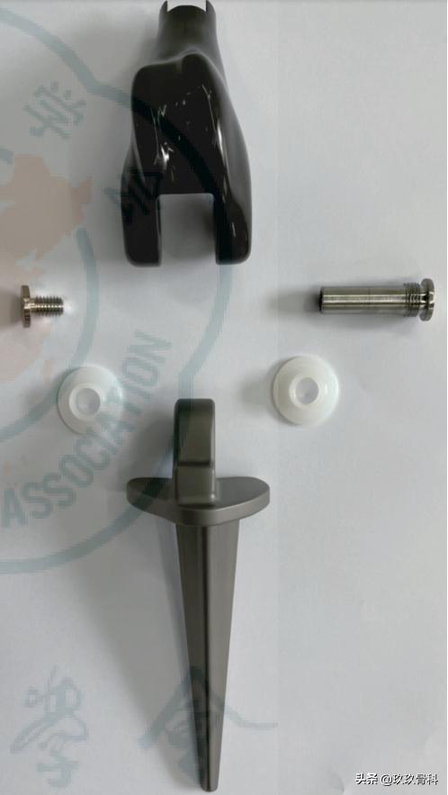 人工关节假体的诞生和发展,国产肿瘤型人工关节假体