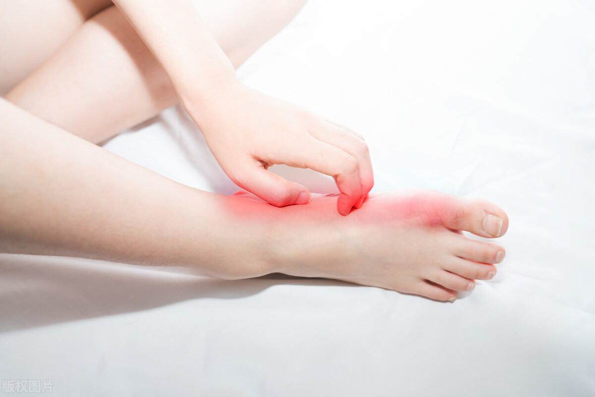 脚后跟干裂不痒是真菌感染吗,脚后跟粗糙与真菌有关系吗