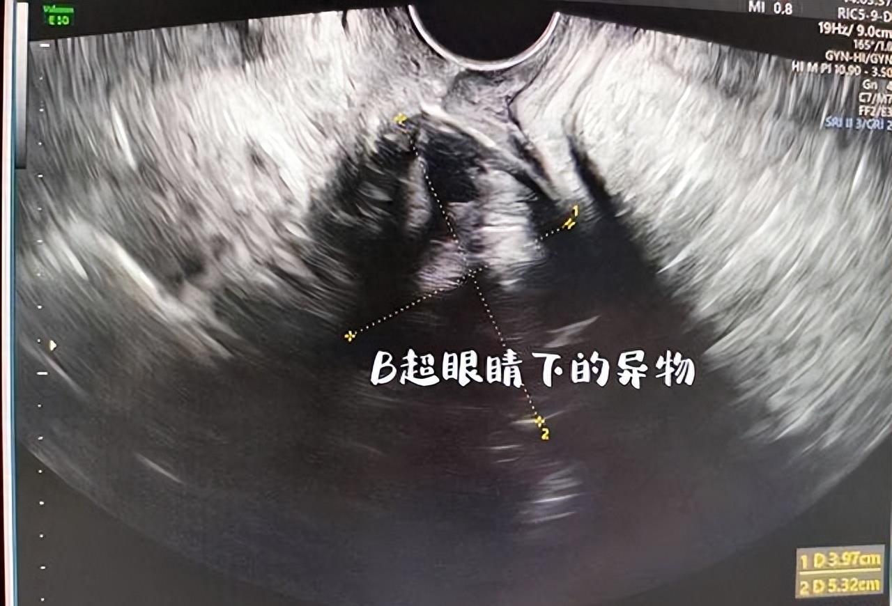 19岁女大学生为寻求刺激，跟男朋友干了一件疯狂的事儿！