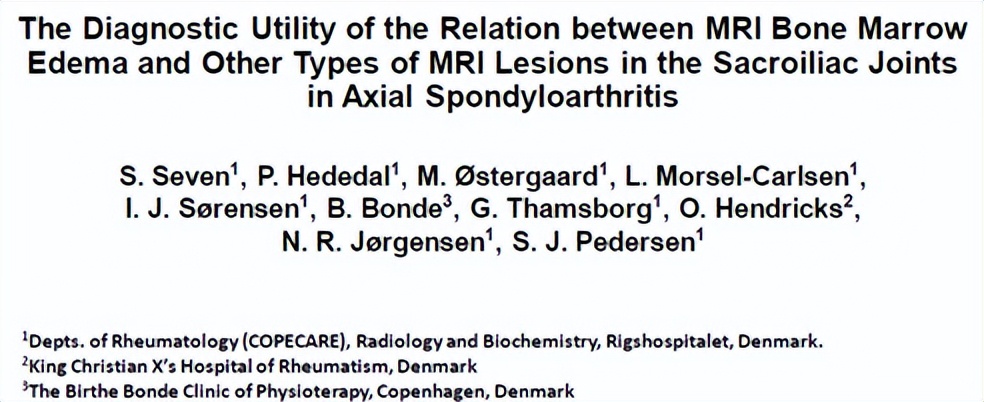 骶髂关节骨髓水肿最好的治疗方案,骶髂关节炎是脊柱关节病的一种吗