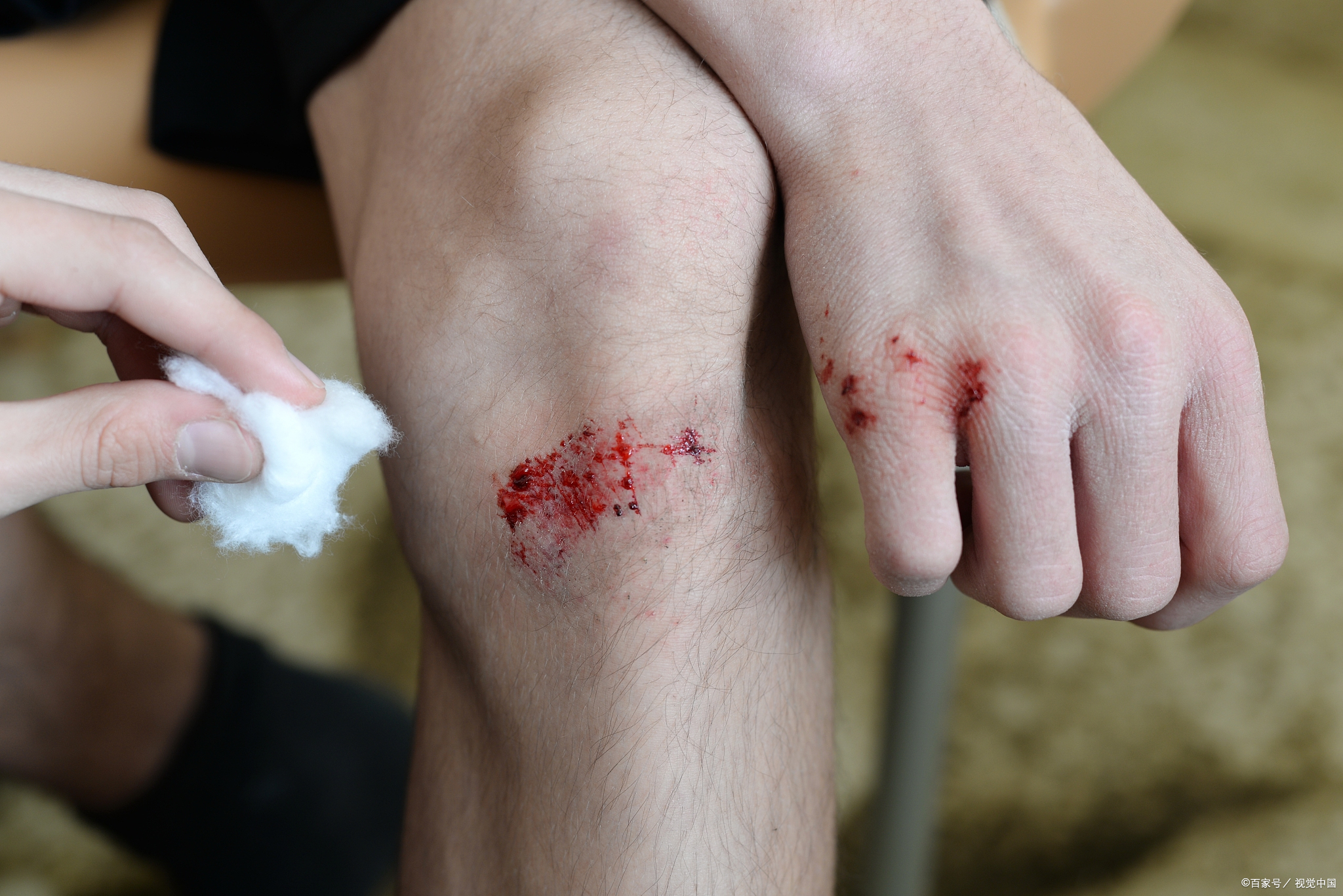 被人打了轻微伤怎么判,入室殴打他人致轻微伤怎么判