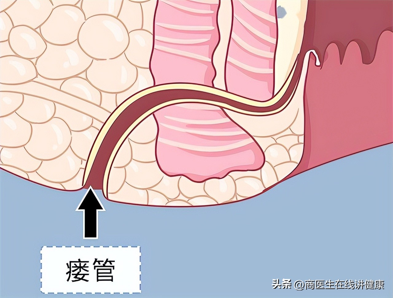 肛瘘不想手术怎么办,为什么肛瘘手术后才是痛苦的开始