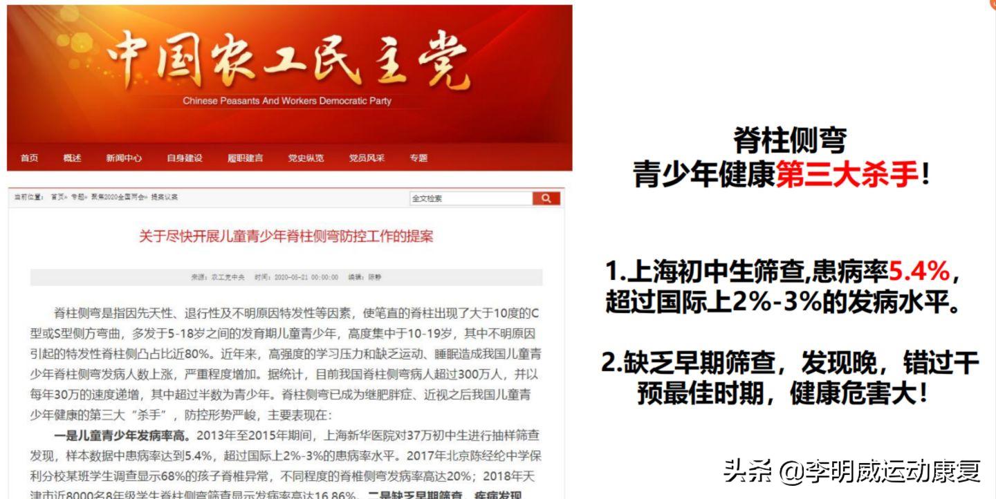 14岁男孩脊柱侧弯怎么训练,14岁女孩脊柱侧弯以后还会加重吗